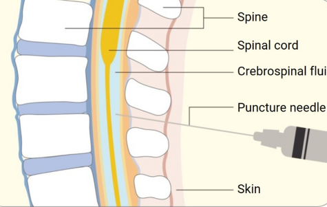 Monitoring for Infection and Malfunction
